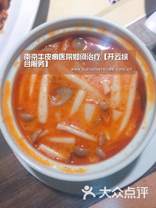 南京牛皮癣医院如何治疗【开云综合服务】(图4) 开云品牌